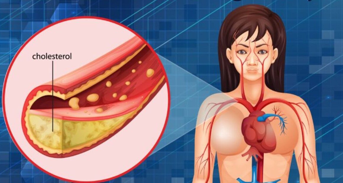 These Foods Increase Cholesterol: Consume Them Carefully During Cold Days