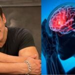 Salman Khan Brain Condition: What These Conditions Mean